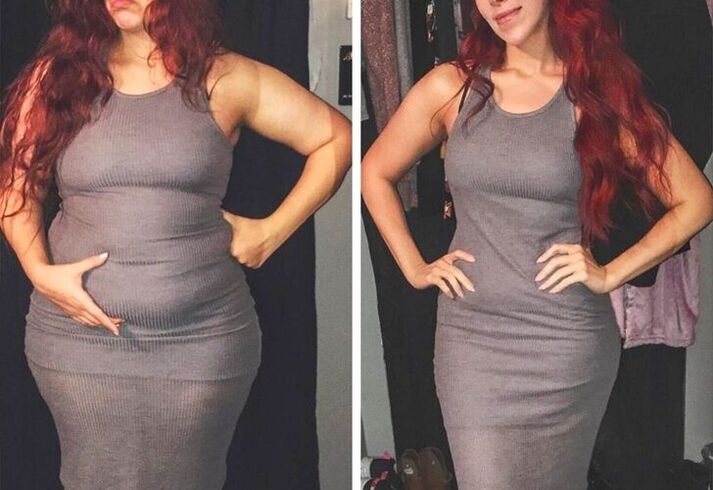 Before and after taking zxcvbnmqwert